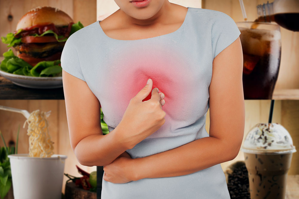 4 Natural Ways to Manage Acid Reflux