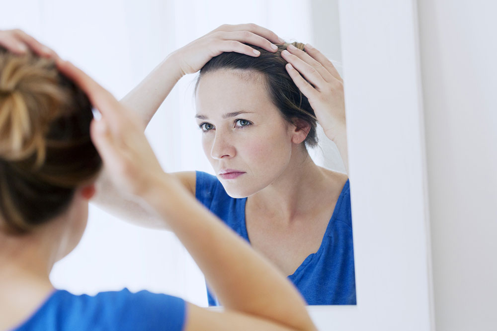 5 Effective Home Remedies for Hair Loss