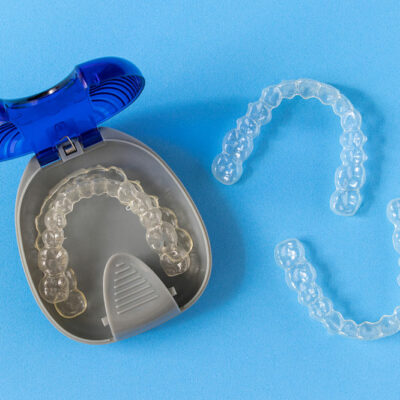 6 Benefits of Clear Braces and Aligners
