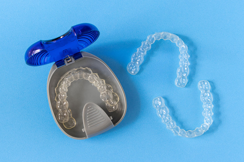 6 Benefits of Clear Braces and Aligners