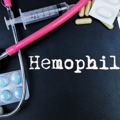 Hemophilia – Signs and Effective Treatment Methods