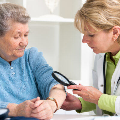 Symptoms, Treatment, and Prevention of Melanoma