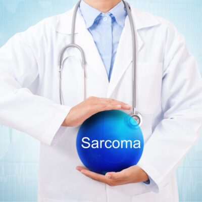Sarcoma – Types and Early Warning Signs